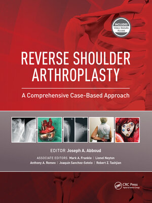 cover image of Reverse Shoulder Arthroplasty